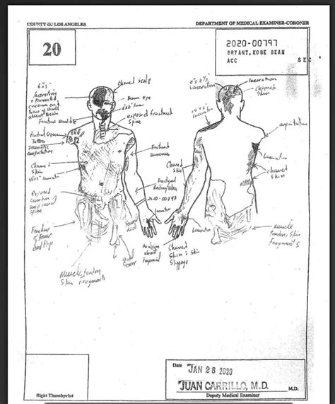 kobe bryant body sketch|Kobe Crash Autopsy Reports : r/CrimeScene